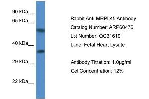 Western Blotting (WB) image for anti-Mitochondrial Ribosomal Protein L45 (MRPL45) (C-Term) antibody (ABIN2788460) (MRPL45 抗体  (C-Term))