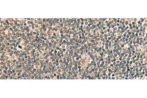 Immunohistochemistry of paraffin-embedded Human tonsil tissue using PRKRA Polyclonal Antibody at dilution of 1:65(x200) (PRKRA 抗体)