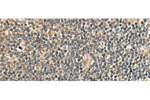 Immunohistochemistry of paraffin-embedded Human tonsil tissue using PRKRA Polyclonal Antibody at dilution of 1:65(x200) (PRKRA 抗体)