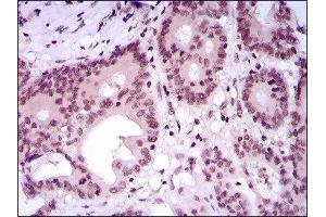 Immunohistochemistry (IHC) image for anti-Myocyte Enhancer Factor 2C (MEF2C) (AA 1-125) antibody (ABIN1846463) (MEF2C 抗体  (AA 1-125))