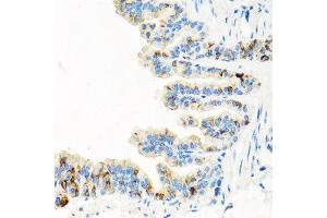 Immunohistochemistry of paraffin-embedded mouse lung using RGS5 antibody at dilution of 1:100 (x40 lens). (RGS5 抗体)