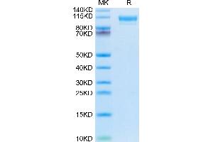 Mouse CD9P1 on Tris-Bis PAGE under reduced condition. (PTGFRN Protein (AA 22-832) (His tag))