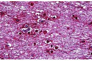 Human Brain, Cortex: Formalin-Fixed, Paraffin-Embedded (FFPE) (HMX2 抗体  (AA 125-224))