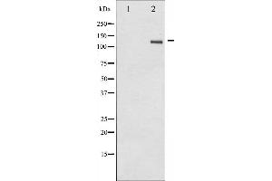 Western blot analysis of SREBP-1 phosphorylation expression in TNF treated Jurkat whole cell lysates,The lane on the left is treated with the antigen-specific peptide. (SREBF1 抗体  (pSer439))