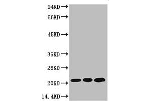 Western blot analysis of 1) MCF7, 2) Rat Kidney Tissue, 3) Mouse Brain Tissue, diluted at 1:2000. (Peroxiredoxin 1 抗体)