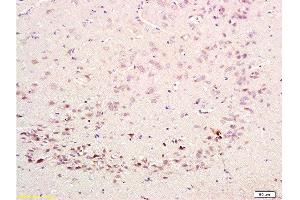 Formalin-fixed and paraffin embedded rat brain labeled with Rabbit Anti-CDK5 Polyclonal Antibody  at 1:200 followed by conjugation to the secondary antibody and DAB staining. (CDK5 抗体  (AA 15-100))