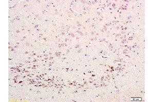 Formalin-fixed and paraffin embedded rat brain labeled with Rabbit Anti-CDK5 Polyclonal Antibody  at 1:200 followed by conjugation to the secondary antibody and DAB staining. (CDK5 抗体  (AA 15-100))