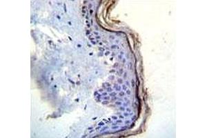 Immunohistochemistry (IHC) image for anti-Mast/stem Cell Growth Factor Receptor (KIT) (AA 106-135) antibody (ABIN3031704)