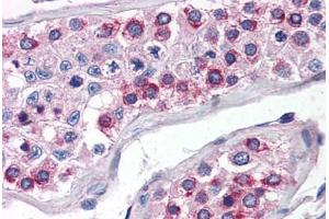 Human Testis (formalin-fixed, paraffin-embedded) stained with ATG16L1 antibody ABIN351446 at 5 ug/ml followed by biotinylated goat anti-rabbit IgG secondary antibody ABIN481713, alkaline phosphatase-streptavidin and chromogen. (ATG16L1 抗体  (N-Term))