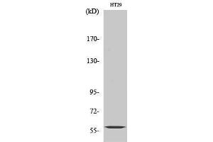Western Blotting (WB) image for anti-Cytochrome P450, Family 2, Subfamily J, Polypeptide 2 (CYP2J2) (Internal Region) antibody (ABIN3184188) (CYP2J2 抗体  (Internal Region))