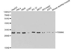 Western blot analysis of extracts of various cell lines, using PSMA6 antibody (ABIN6292835) at 1:1000 dilution. (PSMA6 抗体)