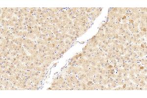 Detection of WNK1 in Human Liver Tissue using Polyclonal Antibody to WNK Lysine Deficient Protein Kinase 1 (WNK1) (WNK1 抗体  (AA 1954-2231))