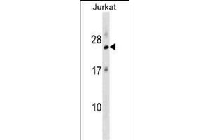 RPL18 Antibody (N-term) (ABIN1538828 and ABIN2849097) western blot analysis in Jurkat cell line lysates (35 μg/lane). (RPL18 抗体  (N-Term))