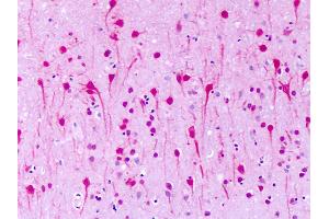 Anti-GPR1 antibody IHC of human brain, neurons. (G Protein-Coupled Receptor 1 抗体  (N-Term))