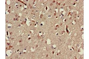 Immunohistochemistry of paraffin-embedded human brain tissue using ABIN7160025 at dilution of 1:100 (MAP3K13 抗体  (AA 506-835))
