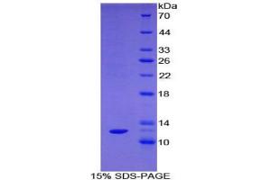 SDS-PAGE analysis of Rat Somatostatin Protein.