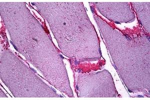 Human Skeletal Muscle, Interstitial Cells: Formalin-Fixed, Paraffin-Embedded (FFPE) (SFRP4 抗体  (AA 239-253))