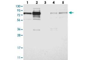 Western blot analysis of Lane 1: RT-4, Lane 2: U-251 MG, Lane 3: Human Plasma, Lane 4: Liver, Lane 5: Tonsil with GRAMD1C polyclonal antibody . (GRAMD1C 抗体)