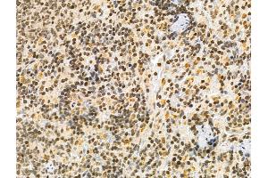 ABIN6261079 and ABIN6276536 at 1/100 staining Rat spleen tissue by IHC-P. (CTCF 抗体  (C-Term))