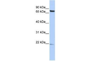WB Suggested Anti-C7orf38 Antibody Titration: 0. (FAM200A 抗体  (Middle Region))