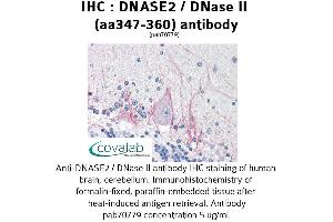 Image no. 2 for anti-Deoxyribonuclease II, Lysosomal (DNASE2) (AA 347-360) antibody (ABIN1733721) (DNASE2 抗体  (AA 347-360))
