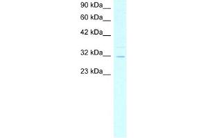 ASGR2 antibody used at 4 ug/ml to detect target protein. (Asialoglycoprotein Receptor 2 抗体  (N-Term))