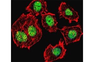 Immunofluorescence (IF) image for anti-Tumor Protein P53 (TP53) (AA 293-322) antibody (ABIN3029384)
