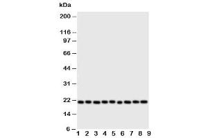 Western blot testing of Cytoglobin antibody and Lane 1:  rat brain (CYGB 抗体  (N-Term))