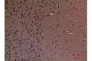 Immunohistochemistry (IHC) analysis of paraffin-embedded Mouse Brain, antibody was diluted at 1:100. (INPPL1 抗体  (Internal Region))