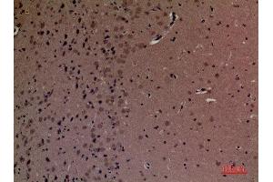 Immunohistochemistry (IHC) analysis of paraffin-embedded Mouse Brain, antibody was diluted at 1:100. (INPPL1 抗体  (Internal Region))