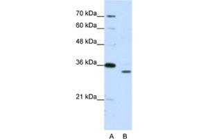 Western Blotting (WB) image for anti-Proteasome Subunit alpha Type 1 (PSMA1) antibody (ABIN2462129) (PSMA1 抗体)