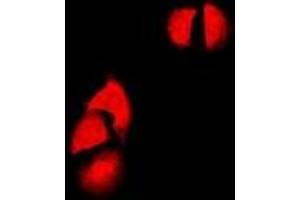 Immunofluorescent analysis of Cyclin D2 staining in SW480 cells. (Cyclin D2 抗体)