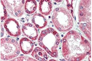 Human Kidney (formalin-fixed, paraffin-embedded) stained with BECN1 antibody ABIN461894 at 2.