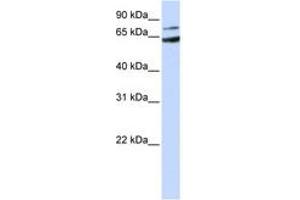 Image no. 1 for anti-Frizzled Family Receptor 8 (FZD8) (AA 144-193) antibody (ABIN6743056) (FZD8 抗体  (AA 144-193))