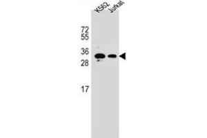 Western blot analysis of HOXA6 / HOX1B Antibody (Center) in K562, Jurkat cell line lysates (35ug/lane). (HOXA6 抗体  (Middle Region))