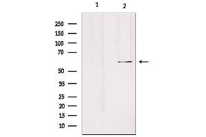 Western blot analysis of extracts from Hela, using SLC24A3 Antibody. (SLC24A3 抗体  (Internal Region))