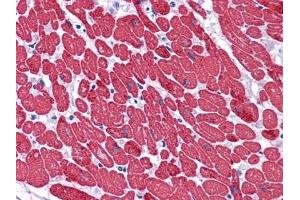Immunohistochemical analysis of paraffin-embedded human Heart tissues using MYL3 mouse mAb. (MYL3/CMLC1 抗体)