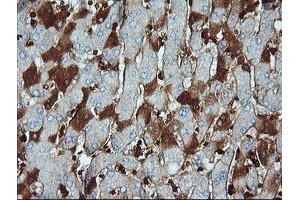 Image no. 1 for anti-Parvin, alpha (PARVA) antibody (ABIN1496444) (Parvin alpha 抗体)