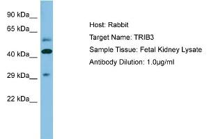 Host: Rabbit Target Name: TRIB3 Sample Type: Fetal Kidney lysates Antibody Dilution: 1. (TRIB3 抗体  (N-Term))