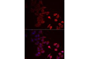 Immunofluorescence analysis of MCF7 cells using P2RX4 antibody (ABIN6132449, ABIN6145115, ABIN6145116 and ABIN6222387). (P2RX4 抗体  (AA 55-338))