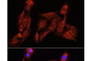 Immunofluorescence analysis of C6 cells using PSAT1 Polyclonal Antibody at dilution of 1:100 (40x lens). (PSAT1 抗体)