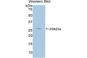 Western Blotting (WB) image for anti-Protein Interacting With Protein Kinase C, alpha 1 (PICK1) (AA 24-229) antibody (ABIN1860209)