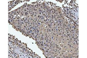 IHC analysis of HOXC4 using anti-HOXC4 antibody (ABIN7603059). (HOXC4 抗体  (Middle Region))