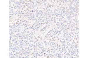 Immunohistochemistry (IHC) image for anti-Structural Maintenance of Chromosomes 3 (SMC3) (C-Term) antibody (ABIN7453572)