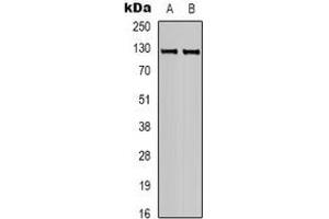 Western blot analysis of CACNA2D3 expression in human brain (A), mouse brain (B) whole cell lysates. (CACNA2D3 抗体)