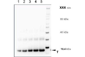 Western Blotting (WB) image for anti-Transmembrane Protein 37 (TMEM37) (N-Term) antibody (ABIN1720796) (TMEM37 抗体  (N-Term))