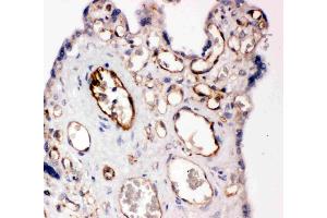 Anti-CD31 antibody, IHC(P): Human Placenta Tissue (CD31 抗体  (C-Term))