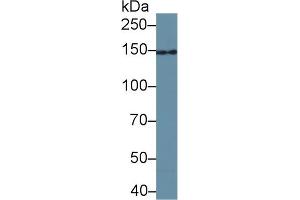 Detection of UACA in Bovine Pancreas lysate using Polyclonal Antibody to Uveal Autoantigen With Coiled Coil Domains And Ankyrin Repeats (UACA) (UACA 抗体  (AA 29-209))