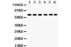 nti- PKC delta antibody, Western blotting All lanes: Anti PKC delta  at 0. (PKC delta 抗体  (AA 1-160))
