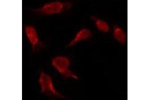 ABIN6275532 staining HepG2 by IF/ICC. (NIM1 抗体  (C-Term))